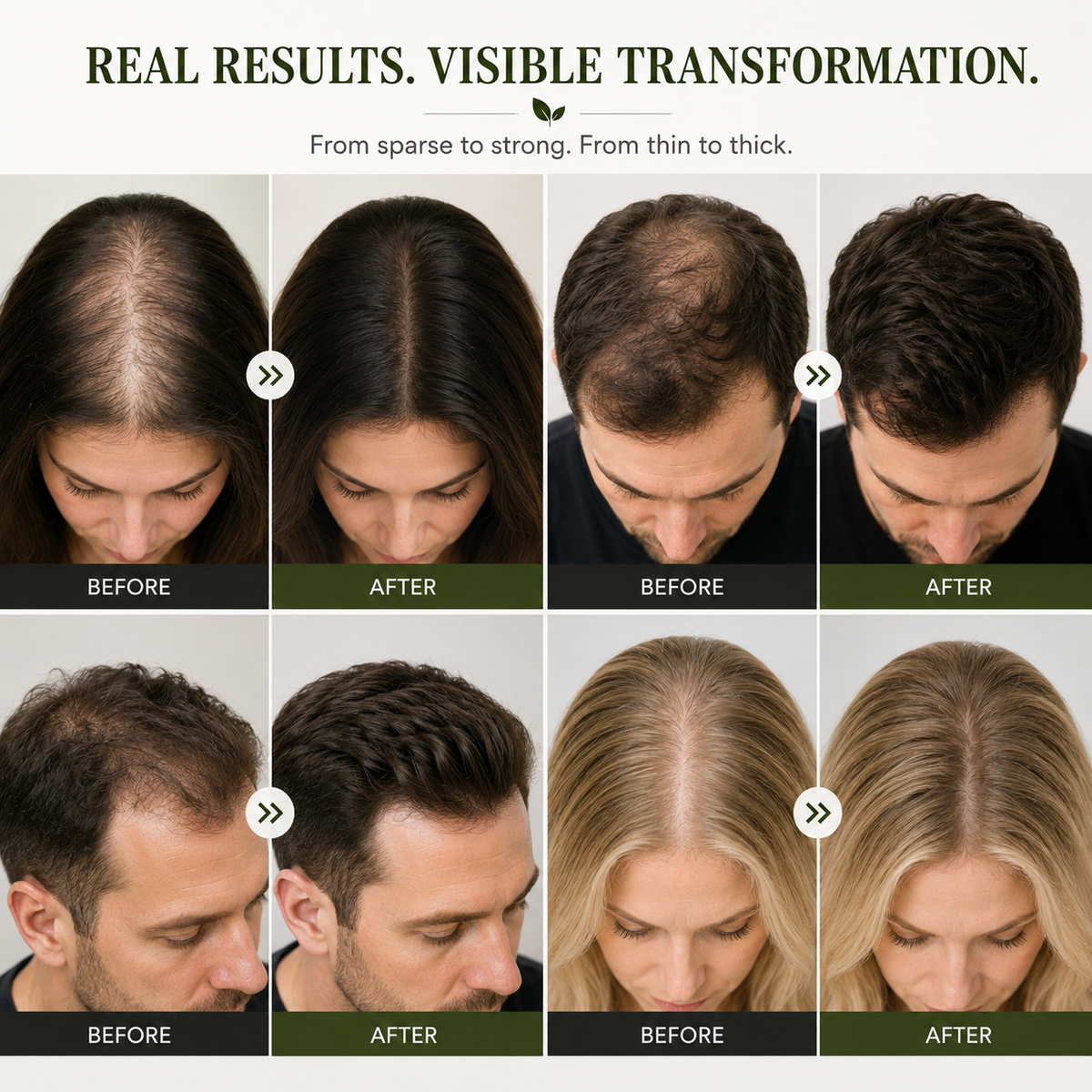 AQA® Scalp Renewal Hair Growth Bar – Deep Cleansing Shampoo for Thinning Hair & Healthier-Looking Hair