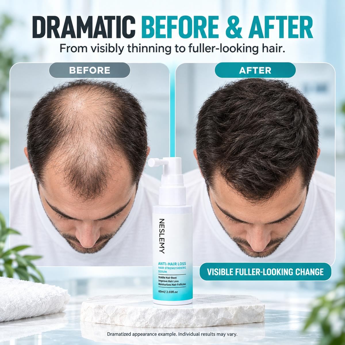 NESLEMY® 5% Minoxidil Hair Regrowth Treatment-Targeted scalp solution for thinning hair and gradual hair loss.