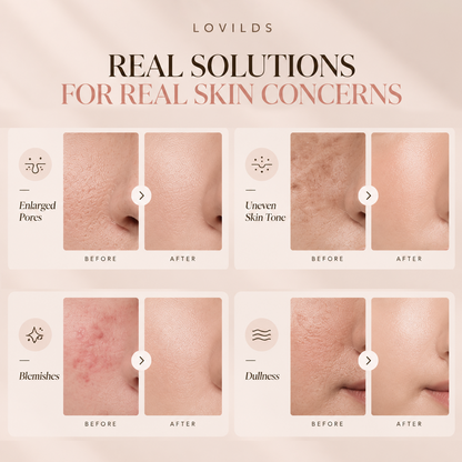 ✨ More Skin, Less Makeup – LOVILDS® CC Tinted Serum for Natural-Looking Coverage