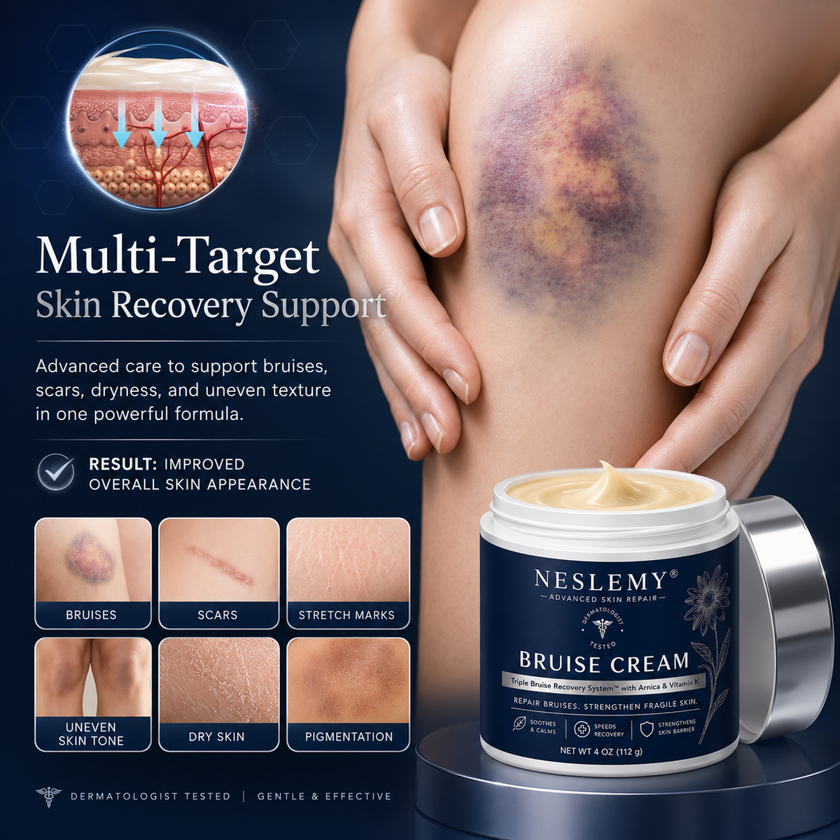 💥100K+ SOLD💕- NESLEMY® Bruise Repair & Skin-Strengthening Cream- Targeted Care for Everyday Bruises