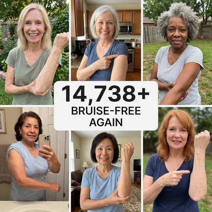 💥100K+ SOLD💕- NESLEMY® Bruise Repair & Skin-Strengthening Cream- Targeted Care for Everyday Bruises